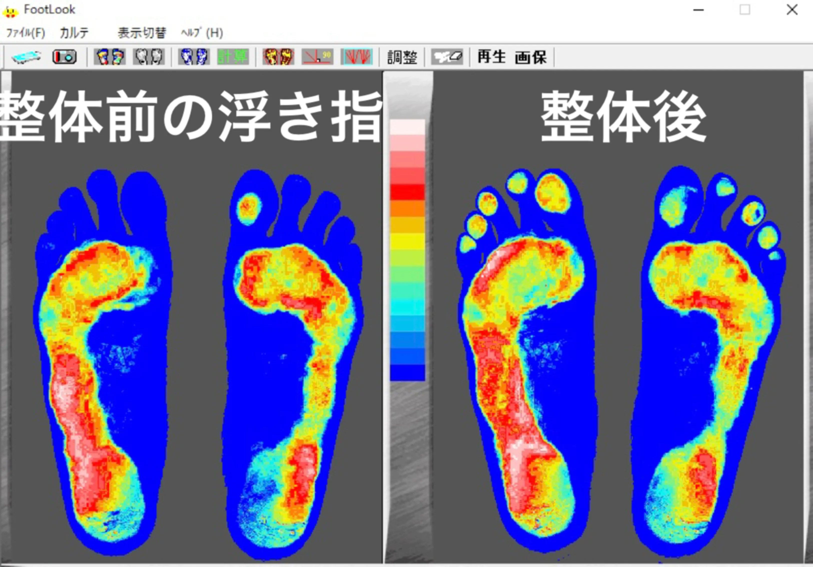 写真-頭痛に対しての施術の様子